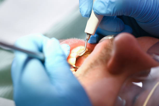 Best Tooth Infection Emergency Dentist  in Covington, VA